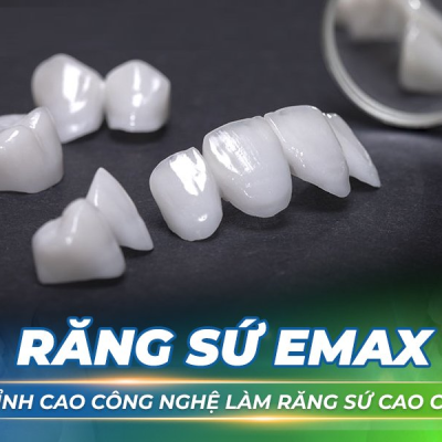RĂNG SỨ EMAX