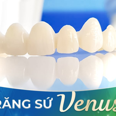 SỨ VENUS